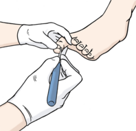 Zwei Hände behandeln einen Fuß